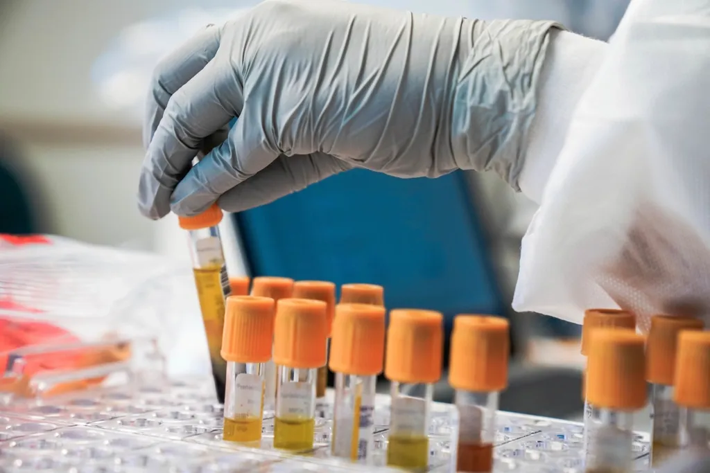 Main gantée manipulant des tubes de prélèvement à bouchon orange dans un portoir