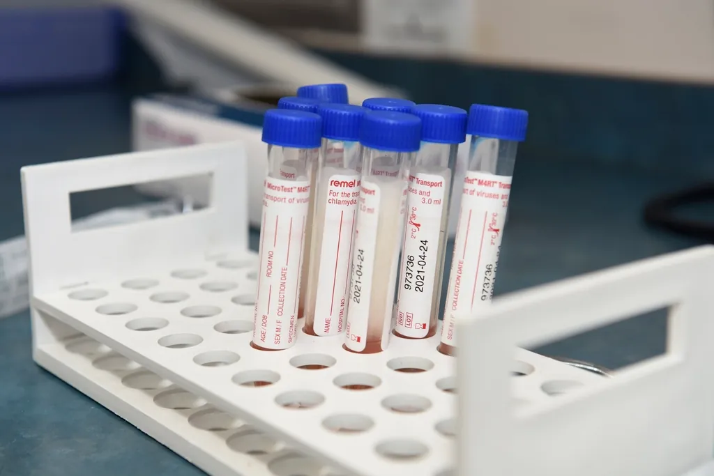Tubes de prélèvement identifiés placés dans un portoir de laboratoire